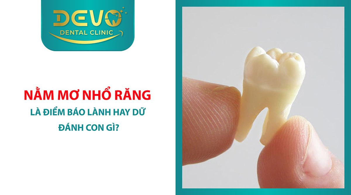 Nằm Mơ Thấy Nhổ Răng Đánh Số Gì? Giải Mã Chi Tiết Và Con Số May Mắn